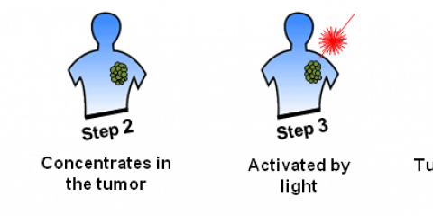 Photodynamic therapy (PDT)